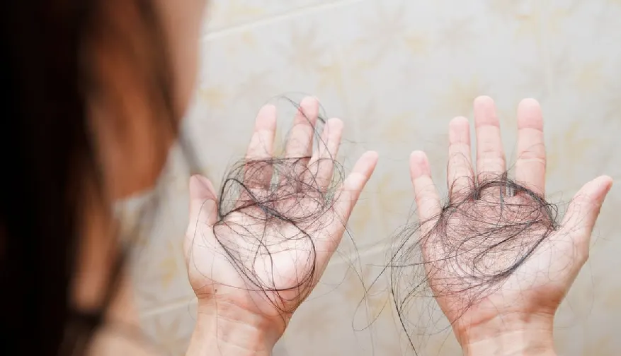 rambut rontok parah