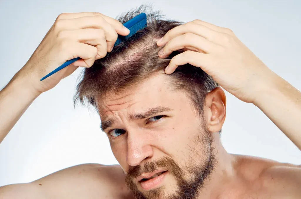 penyebab masalah pada rambut
