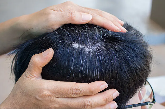 Rambut Hitam Berubah Putih