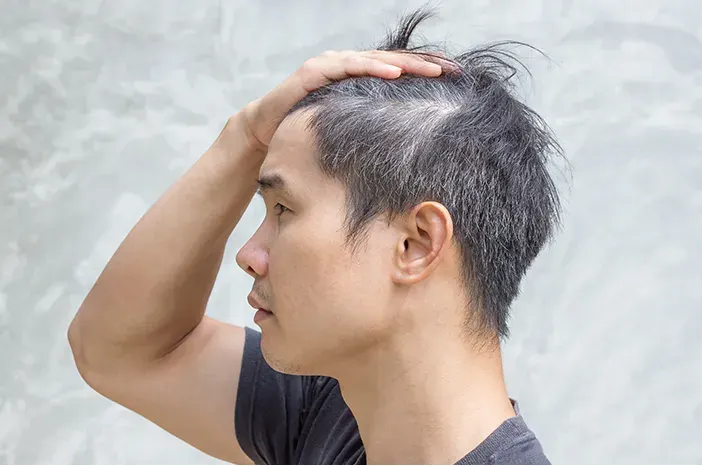 Rambut Putih Sudah Bermunculan